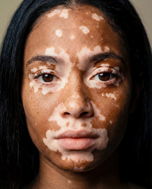 Fond de teint adaptable : le choix idéal pour peaux sensibles - Hailey Beauty
